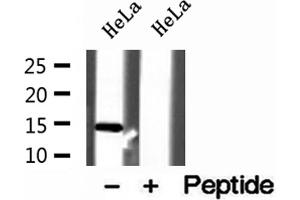 Western blot analysis of extracts of HeLa cells, using UQCRB antibody. (UQCRB anticorps  (N-Term))