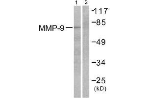 Western blot analysis of extracts from HepG2 cells, using MMP9 antibody (ABIN5976466). (MMP 9 anticorps  (C-Term))