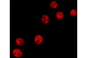 ABIN6277236 staining  Hela cells by IF/ICC. (TCOF1 anticorps  (N-Term))