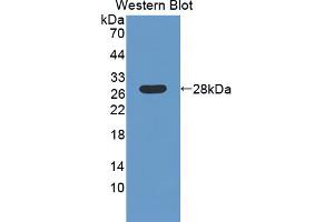 Western blot analysis of the recombinant protein. (LAMb4 anticorps  (AA 1543-1759))