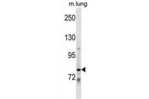 Western Blotting (WB) image for anti-Dachshund 1 (DACH1) antibody (ABIN2999622) (DACH1 anticorps)