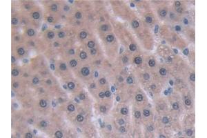 Detection of IL6 in Rat Liver Tissue using Monoclonal Antibody to Interleukin 6 (IL6)