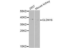 Western blot analysis of extracts of various cell lines, using CLDN16 Antibody (ABIN6003594) at 1/1000 dilution. (Claudin 16 anticorps)