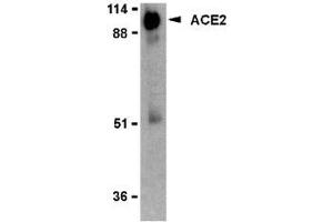 Western blot analysis of ACE2 in human kidney lysate with AP30009PU-N ACE2 antibody (IN2) at 2 μg/ml. (ACE2 anticorps  (Intermediate Domain 2))