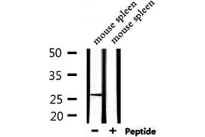 Western blot analysis of extracts from mouse spleen, using ARHGDIA Antibody. (ARHGDIA anticorps  (N-Term))