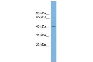 WB Suggested Anti-ZNF367 Antibody Titration:  0. (ZNF367 anticorps  (C-Term))