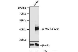 Western blot analysis of extracts of Jurkat cells using Phospho-MAPK3(Y204) Polyclonal Antibody at dilution of 1:2000. (ERK1 anticorps  (pTyr204))