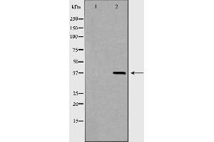 Western blot analysis of extracts of HEK293T, using XRCC4 antibody. (XRCC4 anticorps  (Internal Region))