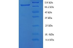 SDS-PAGE (SDS) image for Melanoma Cell Adhesion Molecule (MCAM) (AA 50-646), (partial) protein (His tag) (ABIN5712730)