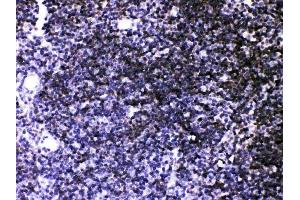 Anti-ATP2A3 antibody, (ABIN3043794), IHC(P)IHC(P): Mouse Thymus Tissue