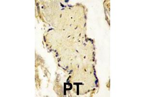 Formalin-fixed and paraffin-embedded placenta tissue reacted with SPPL2A polyclonal antibody  , which was peroxidase-conjugated to the secondary antibody, followed by DAB staining. (SPPL2A anticorps  (N-Term))