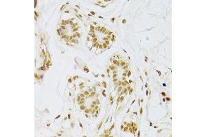 Immunohistochemistry of paraffin-embedded human breast using SNRPA Antibody. (SNRPA1 anticorps  (AA 1-282))