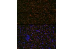 anti-Perilipin 1 (PLIN1) antibody