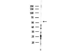 Western blot analysis of lysates from HepG2 cells(heat-shock,45 min treatment), using CSNK1G3 Antibody at 1/1000 dilution.