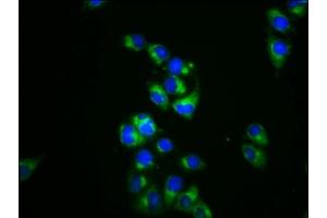 Immunofluorescence staining of Hela cells with ABIN7150934 at 1:133, counter-stained with DAPI. (DRP2 anticorps  (AA 697-833))