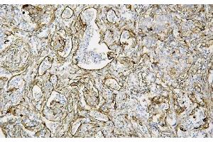 IHC analysis of Caveolin-1/CAV1 using anti-Caveolin-1/CAV1 antibody (ABIN6719534). (Caveolin-1 anticorps  (AA 4-178))