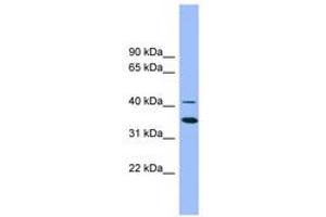 Image no. 1 for anti-GATA Binding Protein 5 (GATA5) (AA 323-372) antibody (ABIN6742225) (GATA5 anticorps  (AA 323-372))