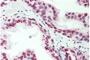 Human Prostate: Formalin-Fixed, Paraffin-Embedded (FFPE)