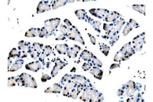 IHC analysis of TCEB2/Elongin-B/ELOB using anti-TCEB2/Elongin-B/ELOB antibody (ABIN7598964).