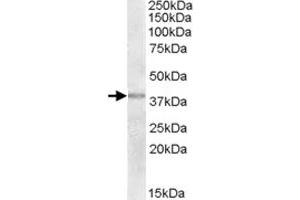 TXNDC6 polyclonal antibody  (2 ug/mL) staining of human uterus lysate (35 ug protein in RIPA buffer). (NME9 anticorps)