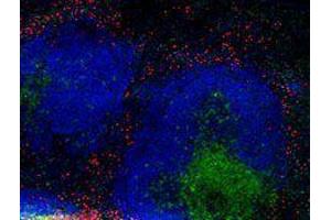 Immunofluorescence (IF) image for anti-Integrin beta 2 (ITGB2) antibody (Alexa Fluor 594) (ABIN2656819) (Integrin beta 2 anticorps  (Alexa Fluor 594))