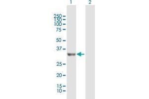 Western Blot analysis of PROSC expression in transfected 293T cell line by PROSC MaxPab polyclonal antibody. (PROSC anticorps  (AA 1-275))