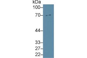 Western Blot; Sample: Rat Liver lysate; Primary Ab: 2µg/ml Rabbit Anti-Rat MMP8 Antibody Second Ab: 0.