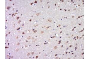 Paraformaldehyde-fixed, paraffin embedded rat brain tissue, Antigen retrieval by boiling in sodium citrate buffer(pH6) for 15min, Block endogenous peroxidase by 3% hydrogen peroxide for 30 minutes, Blocking buffer (normal goat serum) at 37°C for 20min, Antibody incubation with Rabbit Anti-DPAGT1 Polyclonal Antibody, Unconjugated  at 1:500 overnight at 4°C, followed by a conjugated secondary and DAB staining (DPAGT1 anticorps  (AA 301-408))