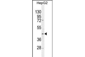 TMLHE antibody  (N-Term)