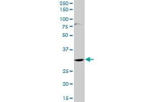 HOXD1 MaxPab rabbit polyclonal antibody. (HOXD1 anticorps  (AA 1-328))