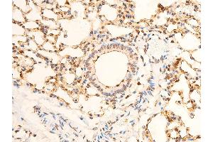 ABIN6267301 at 1/100 staining mouse lung tissue sections by IHC-P.