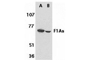 Western Blotting (WB) image for anti-Fem-1 Homolog B (FEM1B) (C-Term) antibody (ABIN1030384) (FEM1B anticorps  (C-Term))