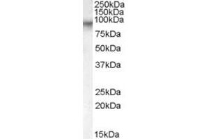 Western Blotting (WB) image for anti-Coagulation Factor XIII, A1 Polypeptide (F13A1) (AA 703-717) antibody (ABIN291434)