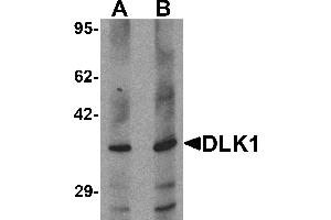 Western blot analysis of HepG2 in 293 cell lysate with DLK1 antibody at (A) 1 and (B) 2 µg/mL. (DLK1 anticorps  (C-Term))