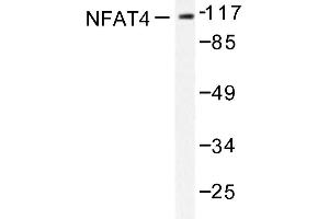 Image no. 1 for anti-Nuclear Factor of Activated T-Cells, Cytoplasmic, Calcineurin-Dependent 3 (NFATC3) antibody (ABIN272044) (NFATC3 anticorps)