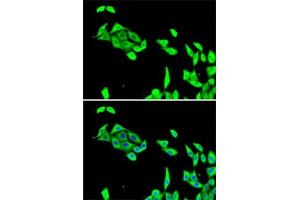 Immunofluorescence analysis of U2OS cells using CDK5 antibody (ABIN6129236, ABIN6138319, ABIN6138320 and ABIN6221397).