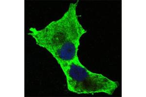 Confocal immunofluorescence analysis of Hela cells using DAXX antibody (green). (DAXX anticorps)