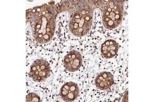 Immunohistochemical staining of human colon with C19orf42 polyclonal antibody  shows moderate cytoplasmic and nuclear positivity in glandular cells. (C19ORF42 anticorps)