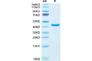 Resistin (RETN) (AA 17-108) protein (Fc Tag)