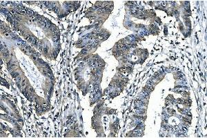 IHC analysis of SLBP using anti-SLBP antibody (ABIN7600074). (SLBP anticorps  (AA 146-270))