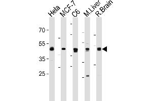MEK2 (P2K2) Antibody (N-term) (ABIN1882178 and ABIN2842061) western blot analysis in Hela,MCF-7,rat C6 cell line and mouse Liver,rat Brain tissue lysates (35 μg/lane). (MEK2 anticorps  (N-Term))