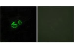 Immunofluorescence analysis of HuvEc cells, using GHRHR Antibody. (GHRHR anticorps  (AA 351-400))