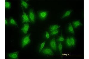 Immunofluorescence of monoclonal antibody to MKNK1 on HeLa cell. (MKNK1 anticorps  (AA 1-465))