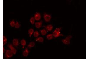 ABIN6272242 staining Hela by IF/ICC. (APOBEC3A anticorps)
