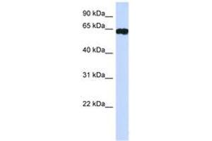 Image no. 1 for anti-Hypermethylated in Cancer 2 (HIC2) (AA 395-444) antibody (ABIN6742231) (HIC2 anticorps  (AA 395-444))