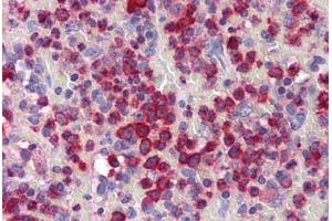 Human Spleen (formalin-fixed, paraffin-embedded) stained with GZMB antibody ABIN351505 at 10 ug/ml followed by biotinylated goat anti-rabbit IgG secondary antibody ABIN481713, alkaline phosphatase-streptavidin and chromogen. (GZMB anticorps  (N-Term))