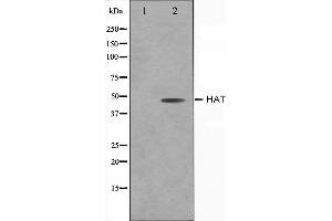 Western blot analysis on LOVO cell lysate using HAT Antibody,The lane on the left is treated with the antigen-specific peptide. (HAT1 anticorps  (C-Term))