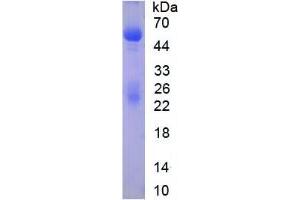 SDS-PAGE analysis of Immunoglobulin G Protein. (IgG Protéine)