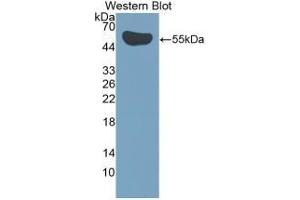 Detection of Recombinant IL35, Human using Polyclonal Antibody to Interleukin 35 (IL35)