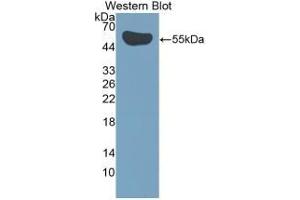 Detection of Recombinant IL35, Human using Polyclonal Antibody to Interleukin 35 (IL35) (Interleukin 35 anticorps  (AA 23-219))